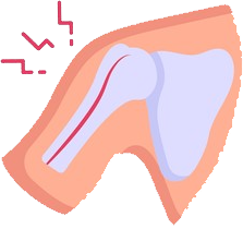 Best Treatment at Pune for Frozen Shoulder, Tendinitis, Brachial Neuralgia