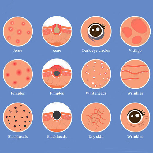 best Skin Disease Treatment